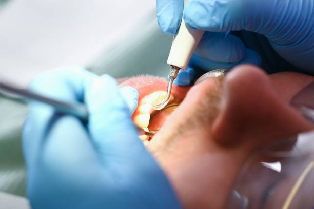 Best Emergency Treatment for Dental Infections or Abscesses in Bellaire, OH