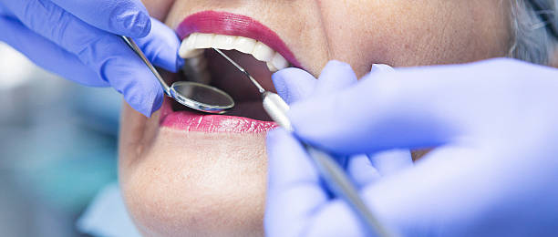Best Emergency Dental Care for Broken or Chipped Teeth in Bellaire, OH